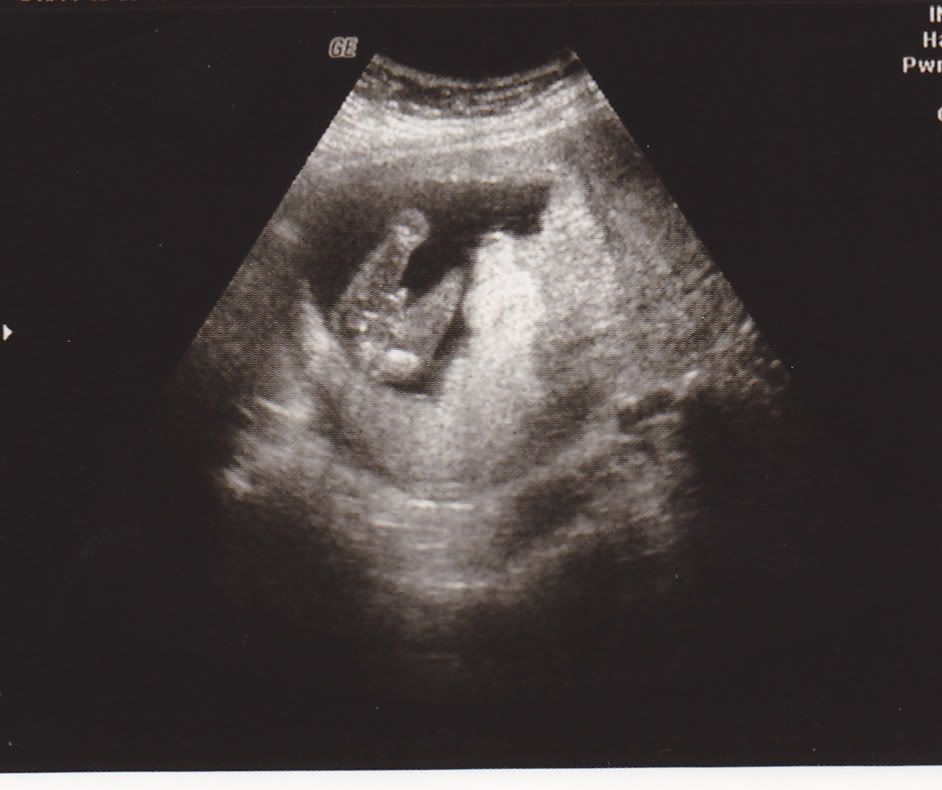 16 weeks potty shot boy ? in Ultrasound Gender Prediction (2010) Forum