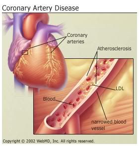 Cholesterol Pictures, Images and Photos